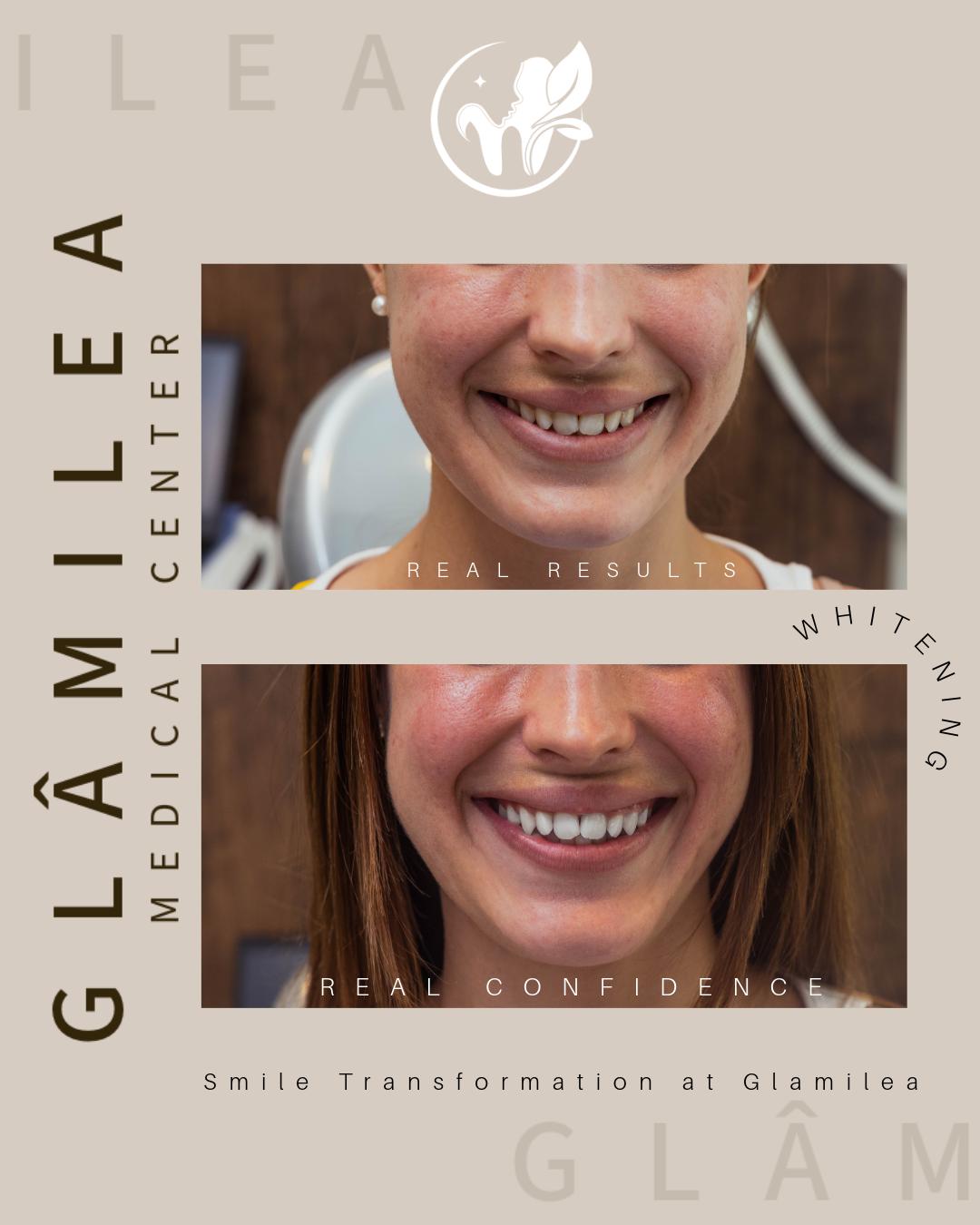Orthodontics (Braces & Clear Aligners)